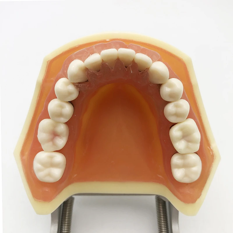 Dental Model Periodontics Calculus Demonstration Teaching Dentists Communication Model 1pc