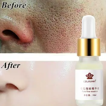 

10ml Hyaluronic Acid Serum Moisturizing Shrink Pore skin Whitening face care Face I8B6