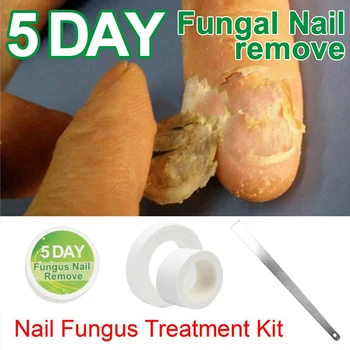 

Toe Nail Fungus Treatment Anti Fungal Nail Infection Essence Nail Treatment Removal Nail Care Lotion Toe Care Foot Care