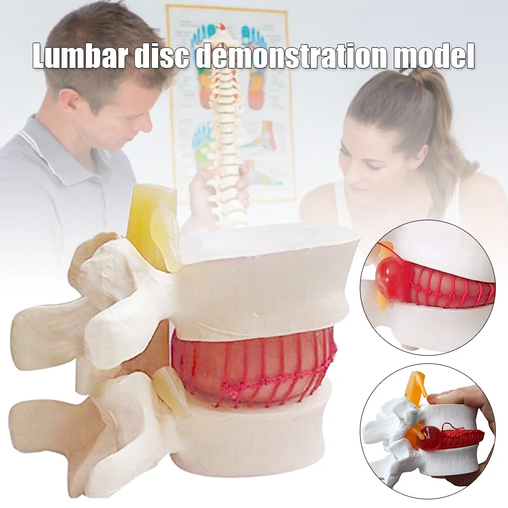 

New 1pc Anatomical Lumbar Disc Herniation Lumbar Spine Model White Color ING-SHIPPING