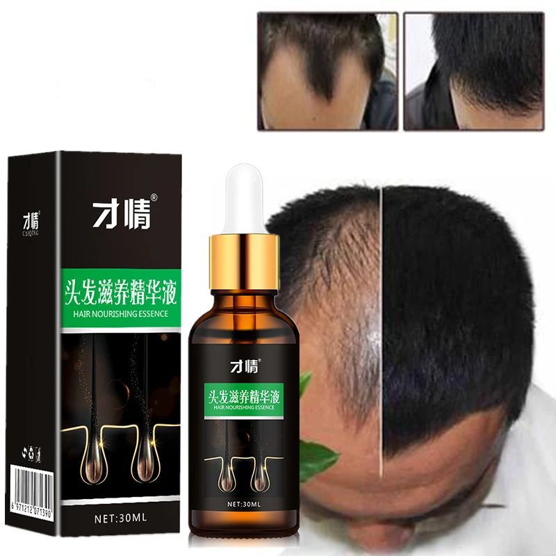 

CAIQING Hot Sale Hair Growth Essence Fast Powerful Hair Growth Essential Oil Hair Loss Treatment Help For hair Growth Hair Care