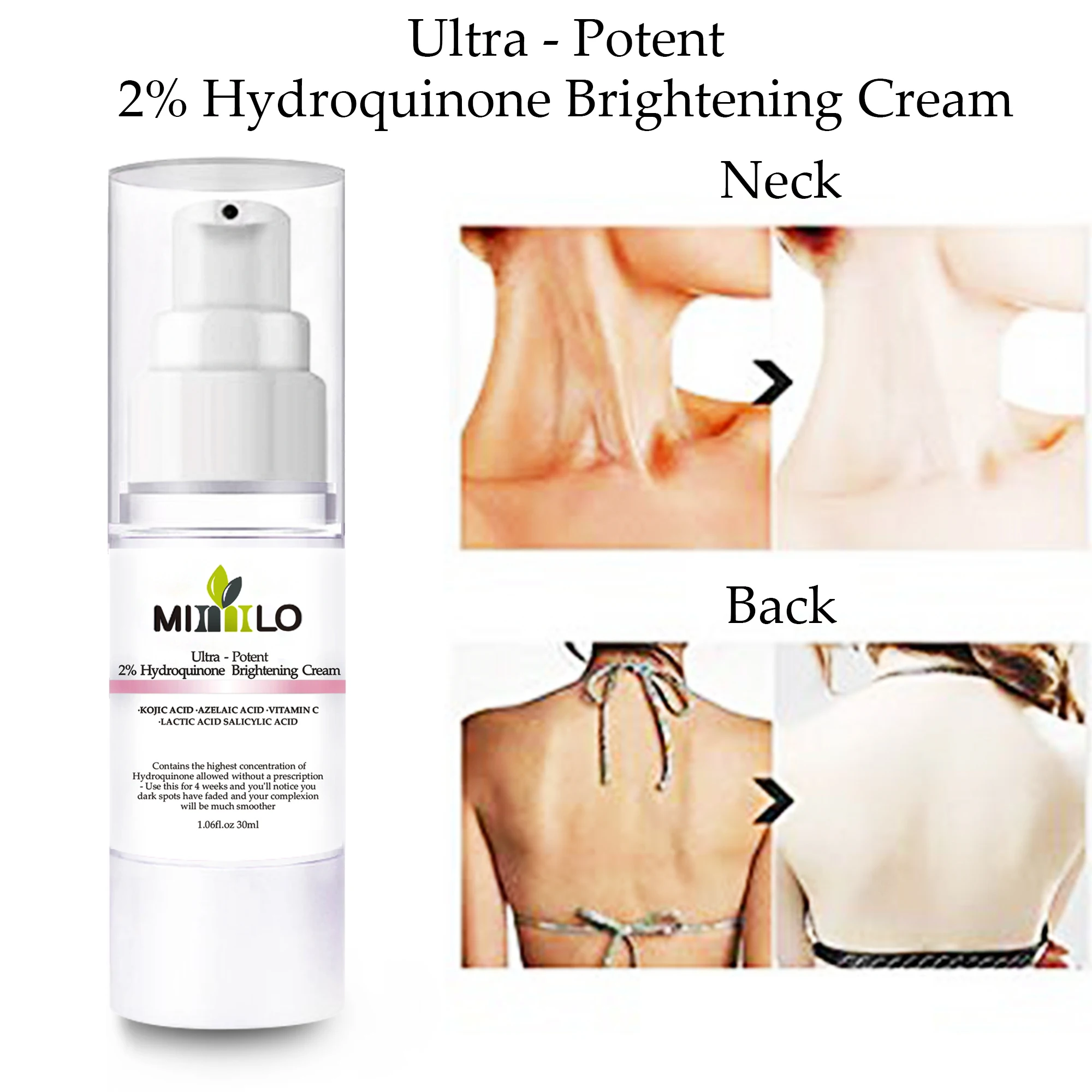 hydroquinone cream for dark neck