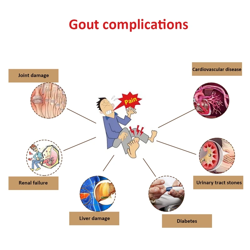 40 pcs/2 Packs Blood Uric Acid Balance Tea for Joint pain edema inflammation Gout Treatment Reduce fat pure natural herbs Tea