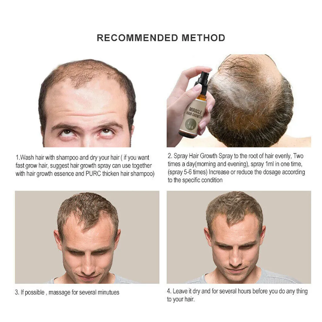 30 дней для роста волос спрей для укрепления волос жидкость быстро расти восстановление плотная Предотвращение волос лечение выпадения волос уход за волосами X#4