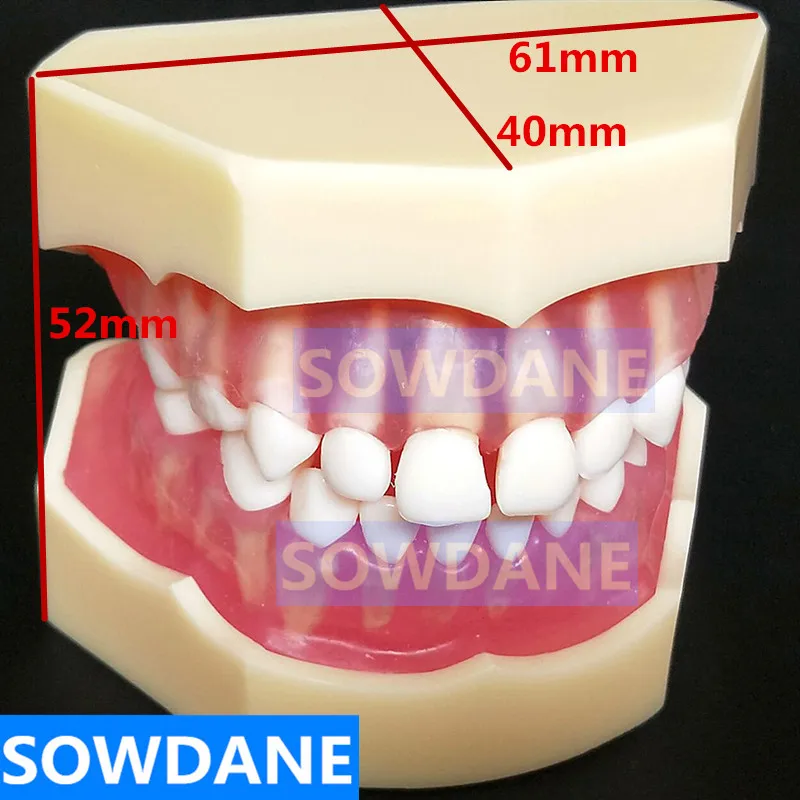  Dental 1:1 Study Teaching Model Dental Children Standard Model Removable Teeth Soft Gum Kid TYPODON - 4000170129781