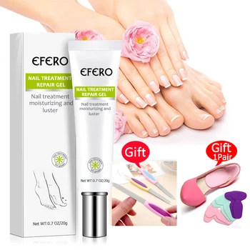 

Nail Fungus Repair Gel Treatment with Nail File Anti Infection Remove Nail Onychomycosis Fungus Toe Nourishing Serum Nail Care