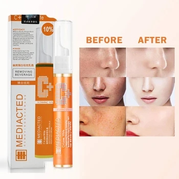 

15ml Anti-Blemish Whitening Cream Pigment Stain Remover Dark Stains Freckle Remover Cream