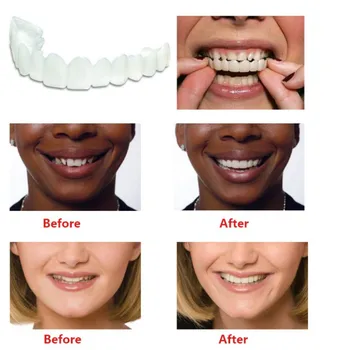

Fake Tooth Cover Teeth Veneers Whitening Snap On Smile Teeth Cosmetic Denture Instant Oral Hygiene Tools Men Women 1pcs