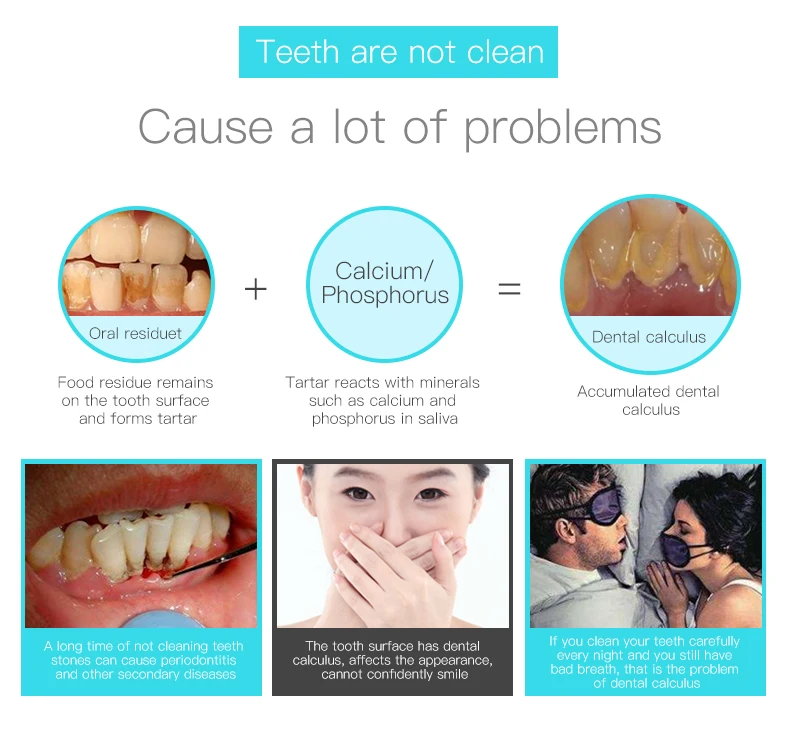 洁牙器2-拷贝_03