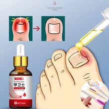 

2PCS Fungal Nail Repair Essence Serum Anti Fungal Nail Treatment Remove Onychomycosis Nourishing Brighten Hand Foot Toes Care