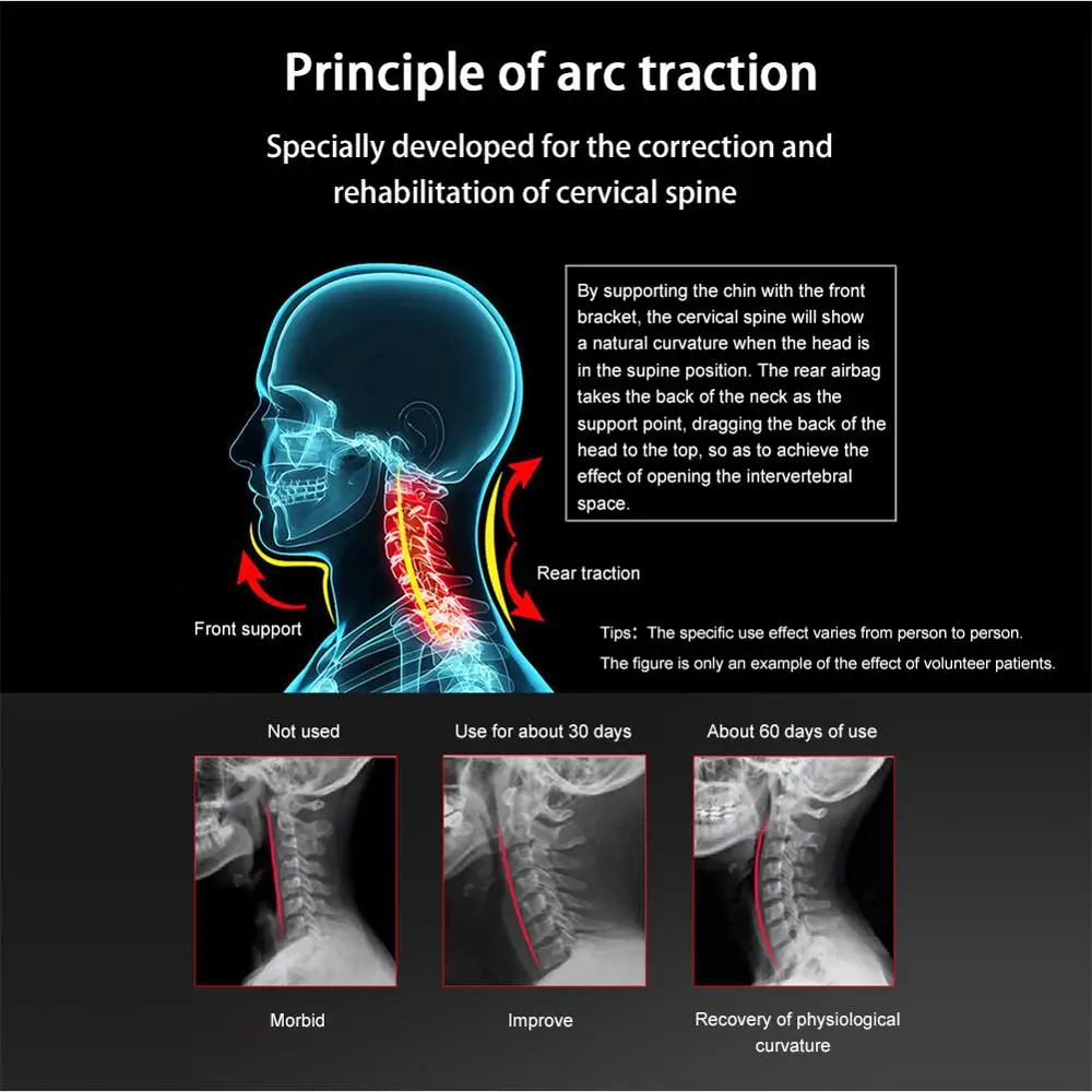 Cervical Traction Neck Support Adult Correction Vertebral Pathology Therapeutic Home Medical Pain Relief Neck Traction Device