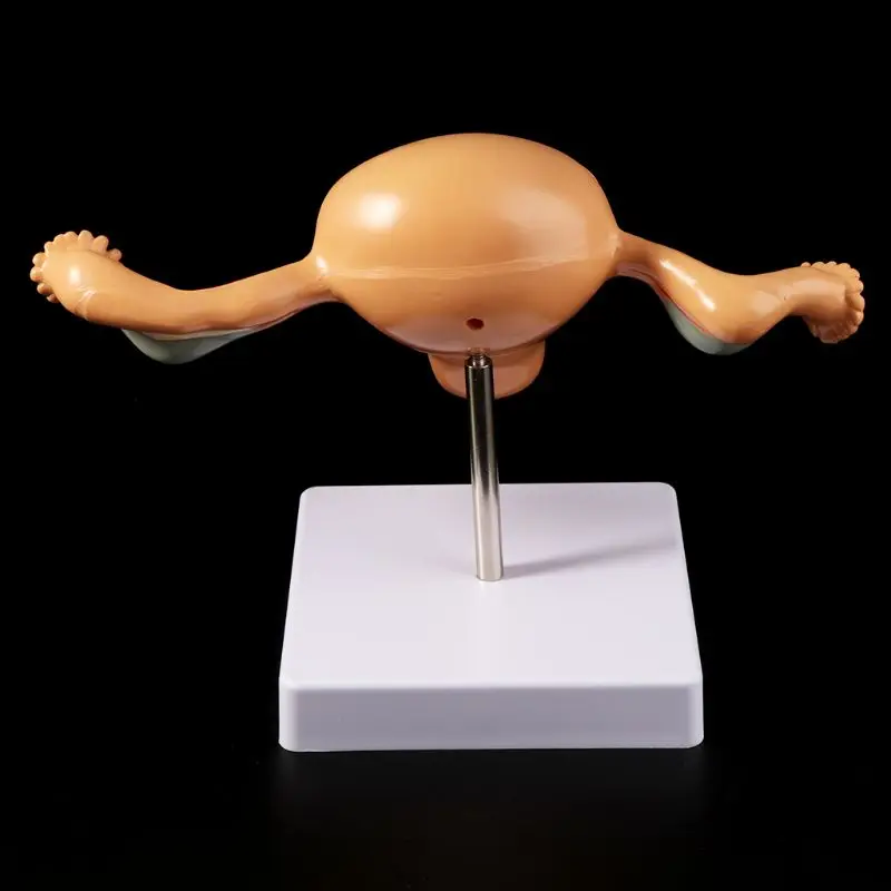 Нормальная модель матки человека патологическая модель яичников анатомическая Анатомия патологическая Травма для обучения