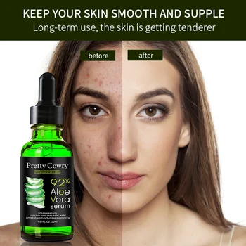 

Face Care Aloe Serum Acne Scar Removal Essence Serum Acne Spots Skin Care Treatment Whitening Remove Acne Face Serums Care