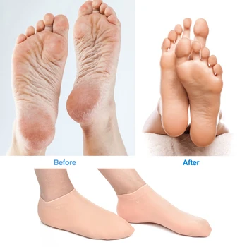 

NEW Silicone Foot Chapped Care Tool Moisturizing Gel Heel Socks Cracked Skin Foot Tools Professional Nursing Health Foot Nursing