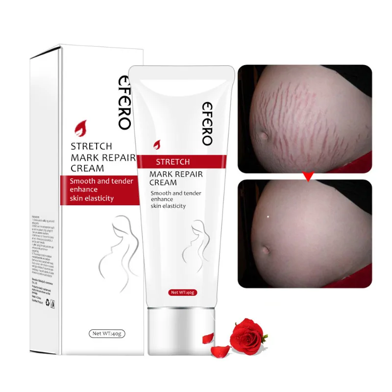 

EFERO Stretch Mark Repair Cream Scar Acne Treatment Firming Skin Repair Obesity Lines Smooth Skin Cream Women Maternity Cream