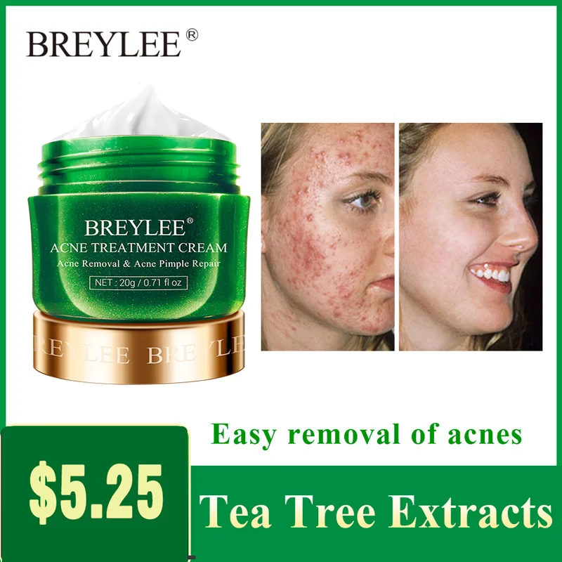 

Tea Tree AcneTreatment Face Cream Anti Acne Pimple Repair Acne marks Oil Control Shrink Pores Whitening Moisturizing skin care