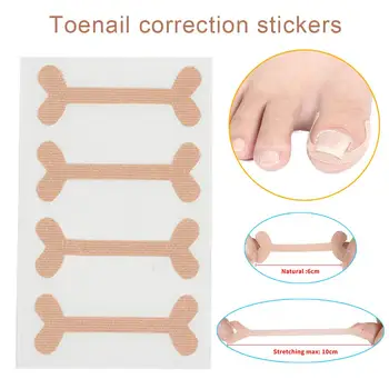 

20Pcs/set Ingrown Toenail Corrector Sticker Paronychia Treatment Fixer Recover Corrector Pedicure Foot Toe Nail Care Tool