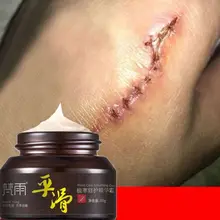 50 г натуральный растительный Восстанавливающий эссенция крем для кожи лица от акне удаление шрамов Лечение пятен увлажняющий от веснушек лосьон Красота Косметика