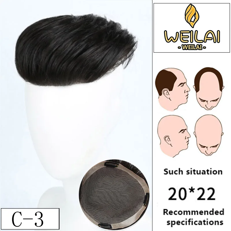 JINJIAN Toupee мужские инъекционные волосы repacement волосы протезизация парик моделирование волос лысый алопеция Наращивание волос украшение - Цвет: C-3