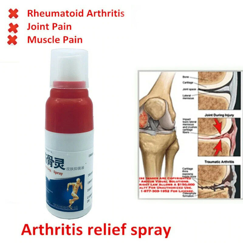 Горячее облегчение боли спрей ревматизм артрит мышечной кости портативный для Sprain колена талии A7