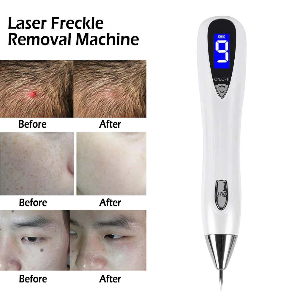 Removedor de Manchas Cuidados com a Pele Varredura Mancha Mole Remoção Verruga Corns Escuras Beleza Máquina Laser Tatuagem Sarda Caneta Lcd 11 Lcd varredura mancha mole remoção verruga corns