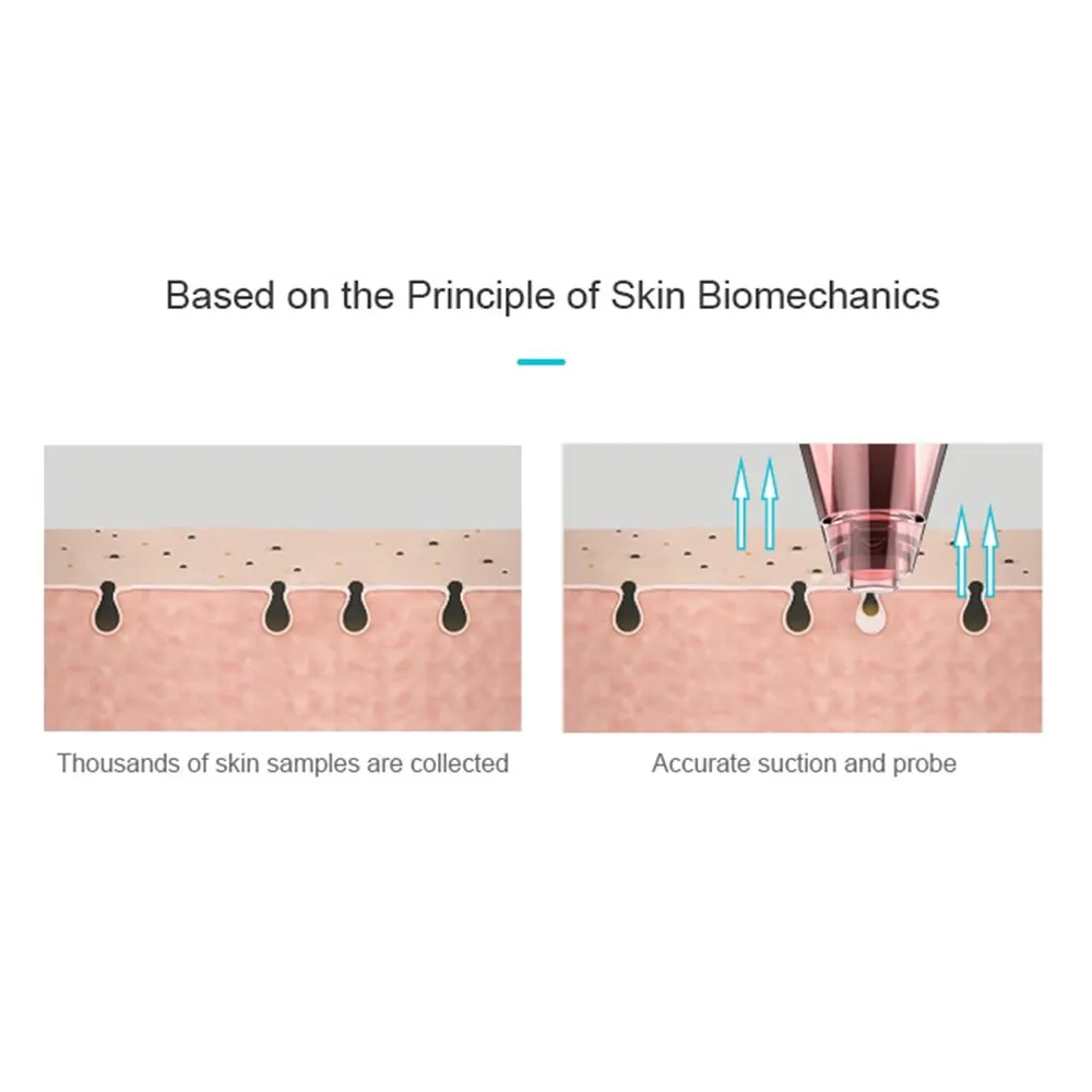 Электрическое вакуумное очищающее средство от черных точек для удаления пор вакуумный Электрический Нос для лица глубокое очищение уход за кожей Очиститель для лица Инструменты