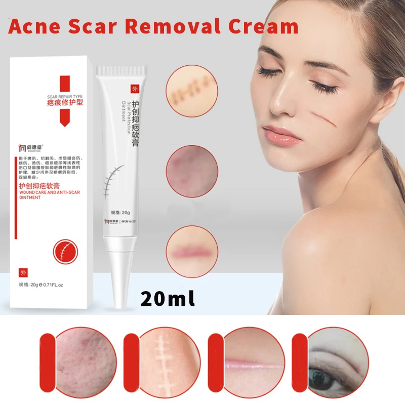 

Acne Scar Removal Cream Face Gel Remove Pimples Stretch Marks Cream Repairing Smoothing Whitening Moisturizing Cream Skin Care