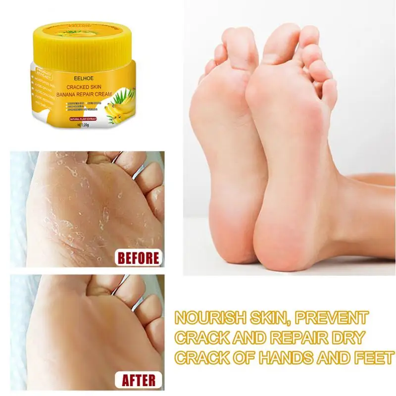 20g Anti Crack Foot Cream Banana Oil Anti-Drying Foot Mask Heel Cracked Repair Cream Removal Dead Skin Hand Feet Care Moisturize