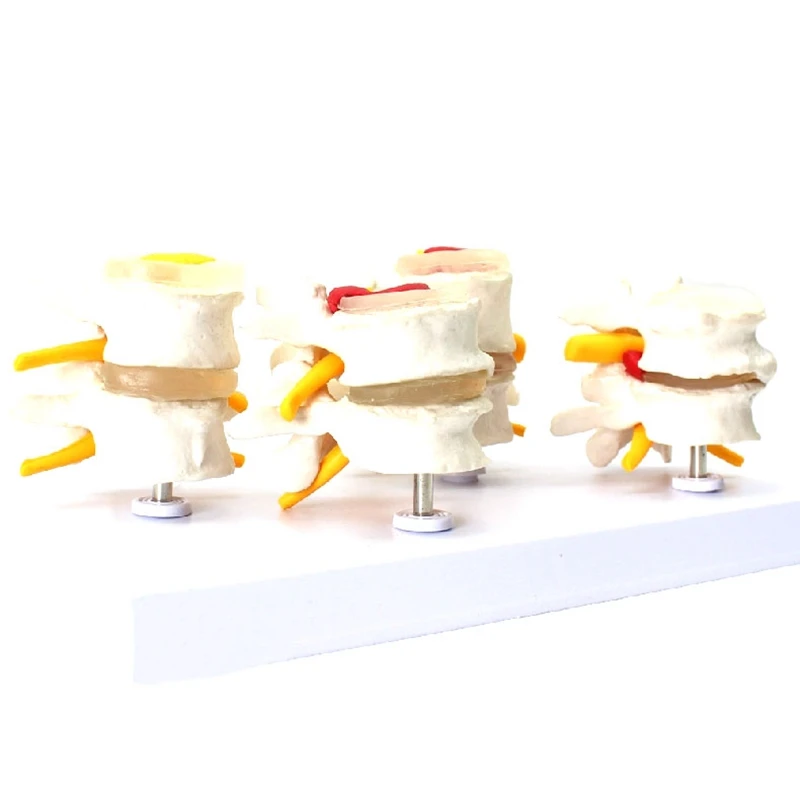 

Human Anatomy Skeleton Spine 4-Stages Lumbar Vertebral Model Brain Skull Traumatic Teaching Supplies