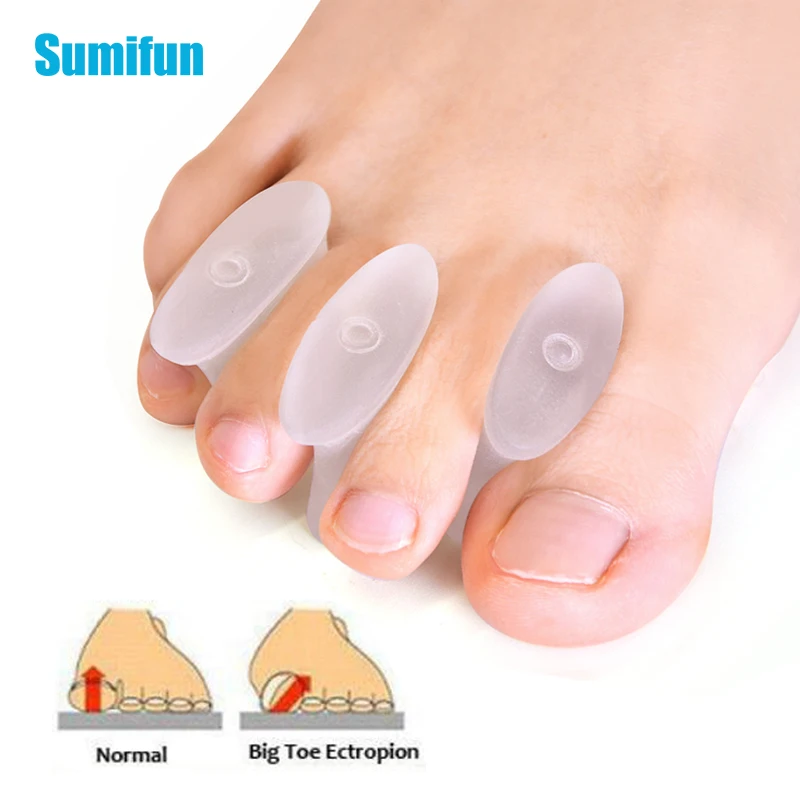 4Pcs Size L Silicone Toe Separator Hallux Valgus Bunion Corrector Straightener Soft Transparent Toe Spacer Foot Care D2973