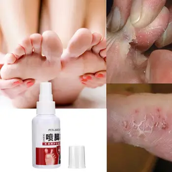 

Refreshing Foot Spray Nourishing Itch Blister Bacteria Treatment Foot Spray Skin Care Tool Nourishing Foot Spray