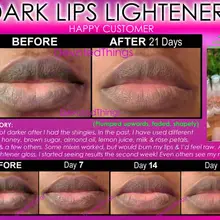 7+ перед и после лучшего осветления губ отбеливатель Осветляющий естественным образом