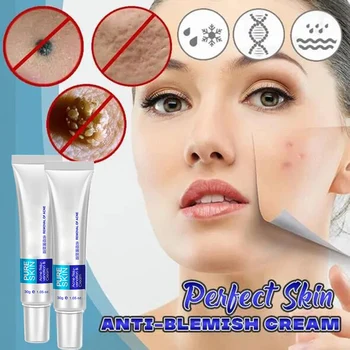 

High Quality Skin Anti-Blemish Cream Minimize Acne Marks Age Spots Brighten Skin Tone Firming Skin