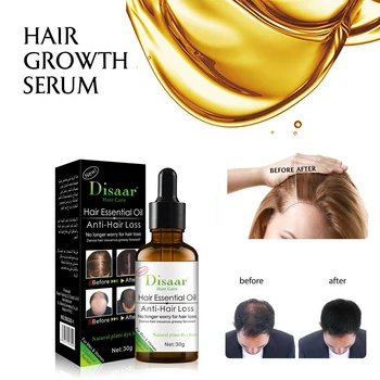 

30ml Natural Extract Liquid Hair Conditioner Hair Loss Essential Oils for scalp Nourishing Leave-in Hair Growth Treatments