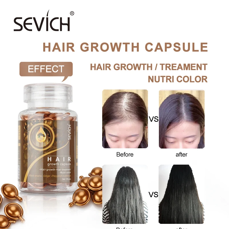 Sevich Hair Vitamin Capsule Ginger Keratin Complex Oil Smooth Silky Anti  Hair Loss Repair White Hair Care Capsule 30pcs/bottle - Hair & Scalp  Treatments - AliExpress