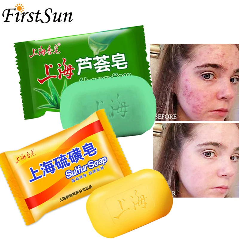 

99% Aloe Soothing Gel Aloe Vera Gel Skin Care Remove Acne Soap Moisturizing Body and Facial Soap Sunscreen Shanghai Sulfur Soap