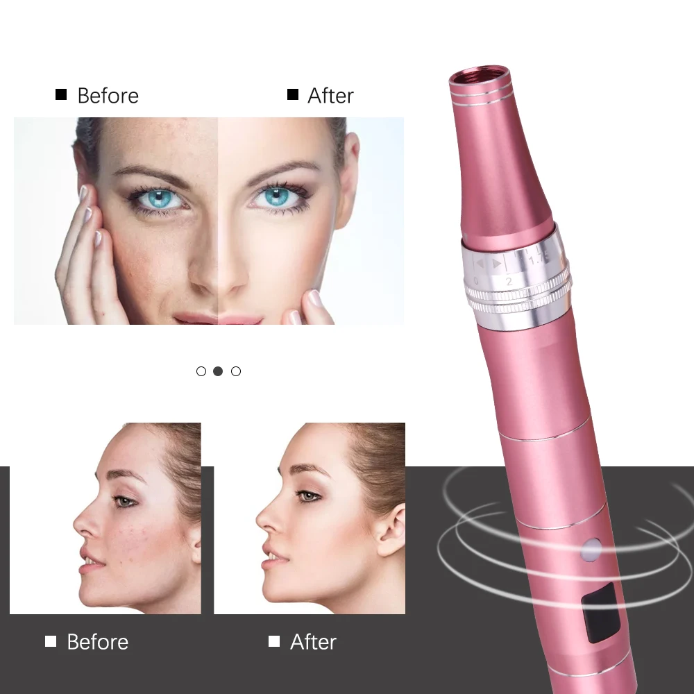 Drahtlose Dr Stift Ultima Dermapen Professionelle Microneed Stift Schraube Mesotherapie Auto Micro Nadeln Gerät Mit Schraube Patrone