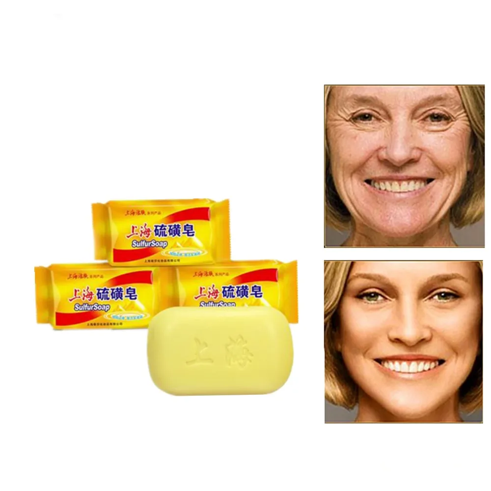 Традиционное мыло китайской медицины. Здоровое состояние кожи. Лечение от акне, псориаза, себорейной цеды. Антигрибковое мыло