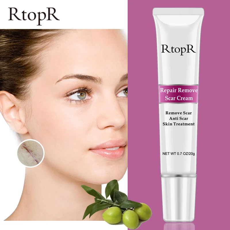 RTOPR Acne Scar Stretch Marks Remover Cream Skin Repair Face Cream Acne