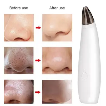 

Remover Blackhead Cleaner Household Electric Blackhead Removal Suction Face Pores Cleaning Vacuum Suction Device Instrument