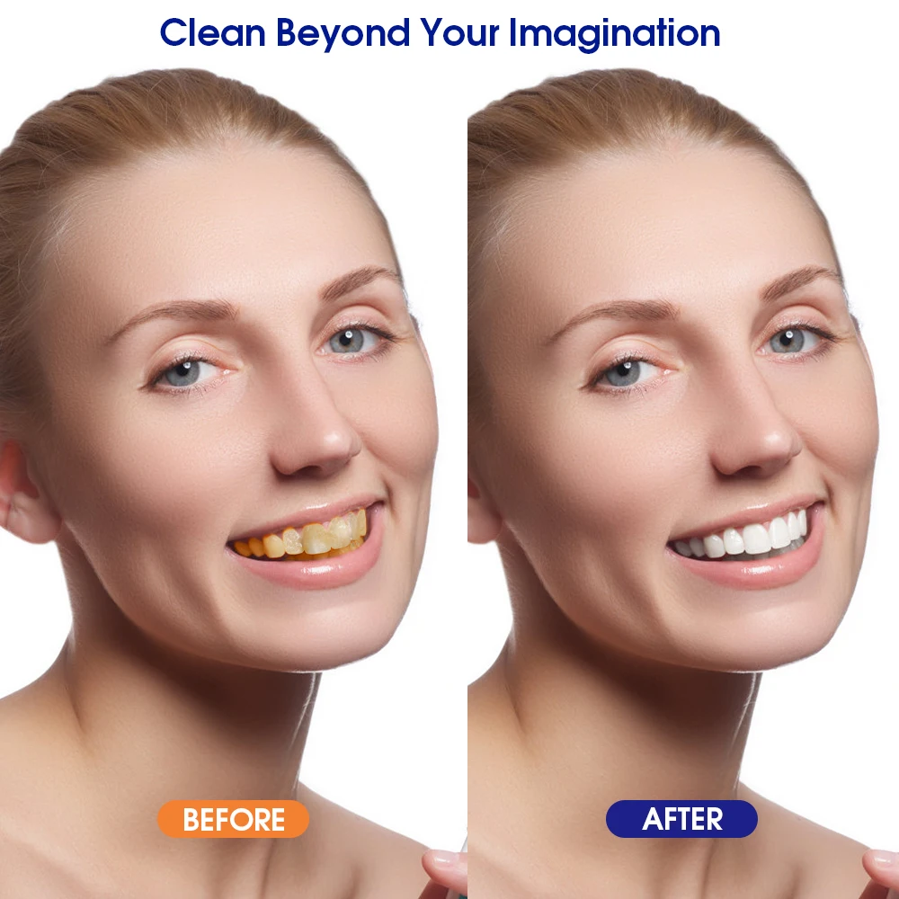 Electric Tooth Calculus Remover Sonic Dental Scaler Oral Irrigator Household Teeth Stains Tartar Tool Teeth Whitening Cleaner oral irrigator,dental cleaner,dental scaler