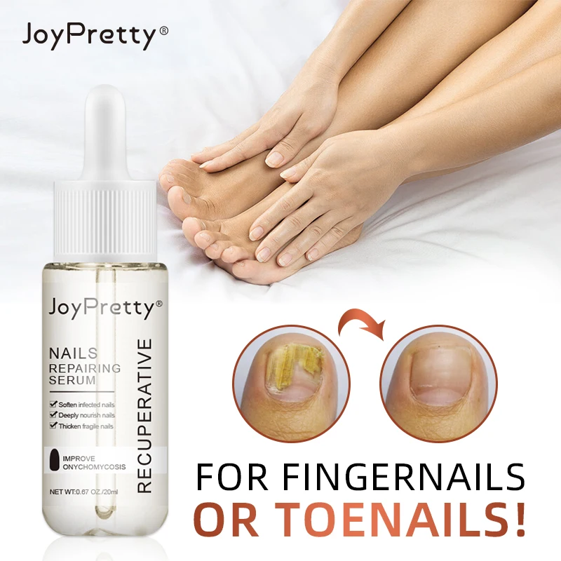 JoyPretty Foot Nail Fungus Treatment Serum Anti Fungi Nails Care