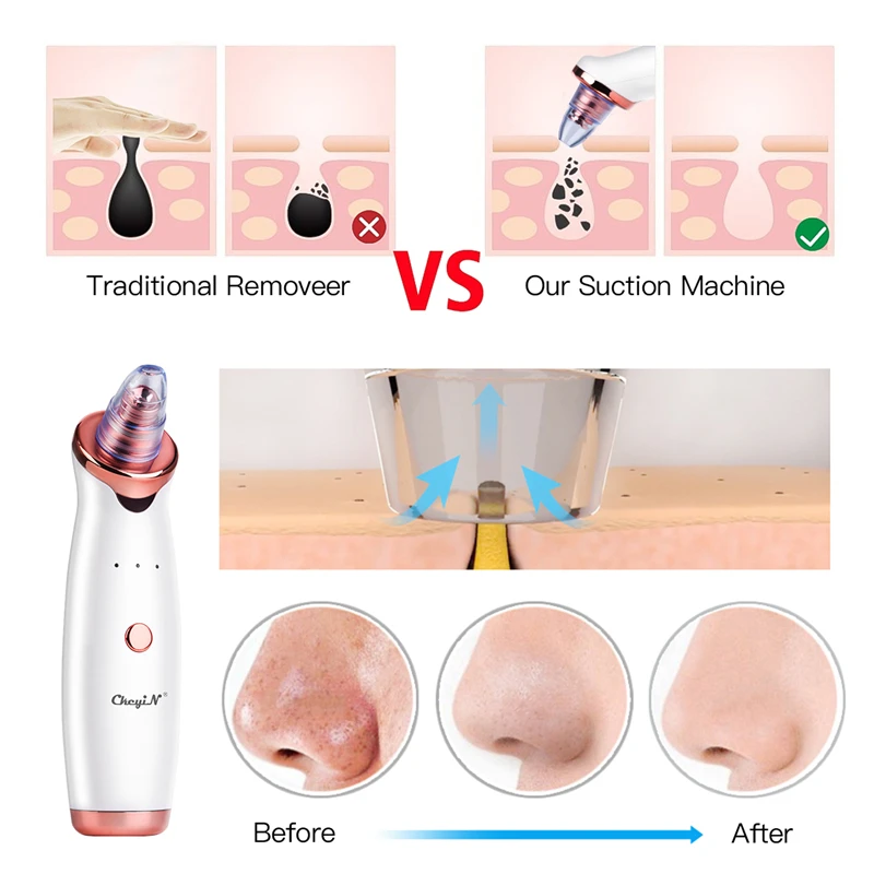 Electric Vacuum Suction Cleaner Face Cleaning Blackhead Removal Black Spot Facial Cleansing Machine Skin Scrubber Pore Cleanser ► Photo 3/6