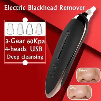 

Electric Blackhead Remover Vacuum Acne Facial Pore Cleanser Removal Tool USB with 4 Replacement Heads for Women Face Beauty