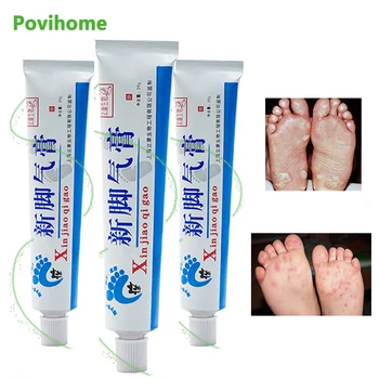 

3Pcs Foot Cream Foot Corn Removal Athlete's Erosive Beriberi Anti Itching Sweat Odor Feet Psoriasis Antibacterial Ointment P1028