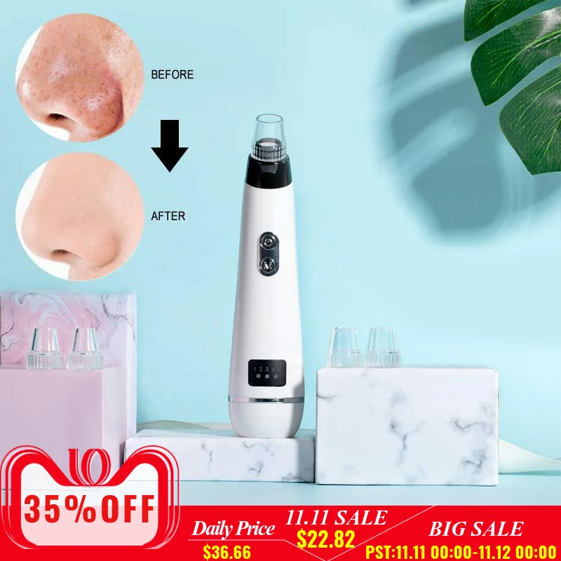 

Electric Dark Spot Blackhead Remover Vacuum pore cleaner For Face odkurzacz do twarzy Microdermoabrasion Comedone Extractor