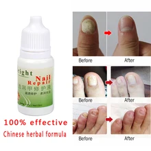 Травяные Антибактериальные Средства для ухода за ногтями жидкое лечение онихомикоза стерилизация ногтей ремонт грибка восстанавливает здоровые ногти