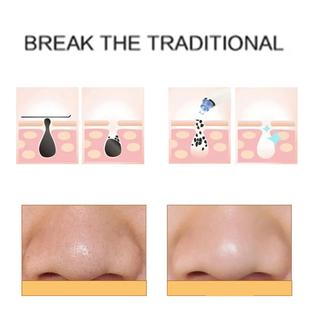 Electric Blackhead Remover Pore Vacuum Suction Acne Face Skin Care Cleaner USB Rechargeable Blackhead Comedo Vacuum 1 Electric Blackhead Remover Pore Vacuum Suction Acne Face Skin Care Cleaner USB Rechargeable Blackhead Comedo Vacuum 2