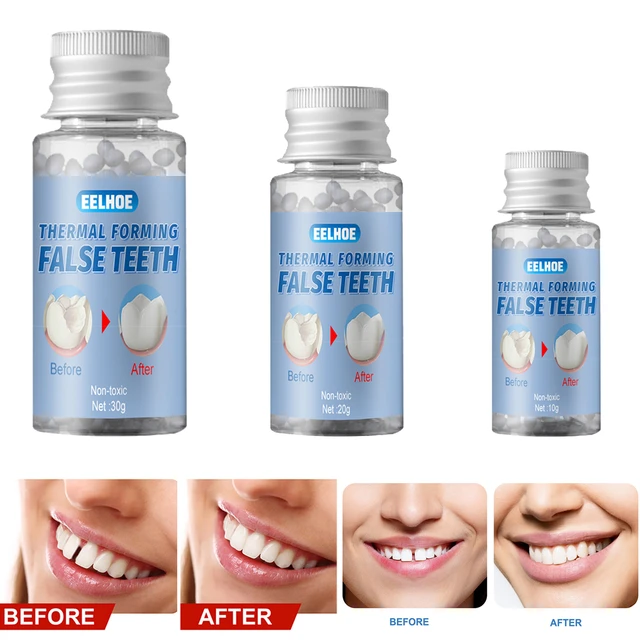 10g Temporary Tooth Repair Kit White Fake Teeth Veneer Thermal Beads  Adhesive Beads - Denture Care Products - AliExpress