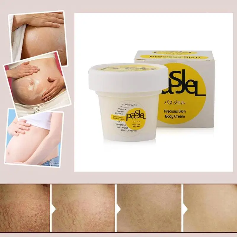 Stretch Mark Repair Cream Repair Beauty Cream